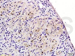 Neurokinin B receptor Rabbit anti-Human, Polyclonal, Bioss 100 &mu;L; Unconjugated:Antibodies,