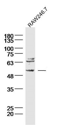 Neurokinin B receptor Rabbit anti-Human, Polyclonal, Bioss 100 &mu;L; Unconjugated:Antibodies,