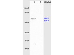 Estrogen Receptor alpha + beta Rabbit anti-Human Mouse Rat, Polyclonal,