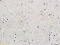 Nociceptin receptor Rabbit anti-Human, Polyclonal, Bioss 100 &mu;L; Unconjugated:Antibodies,