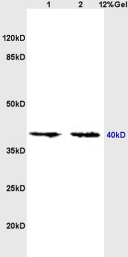 Nociceptin receptor Rabbit anti-Human, Polyclonal, Bioss 100 &mu;L; Unconjugated:Antibodies,
