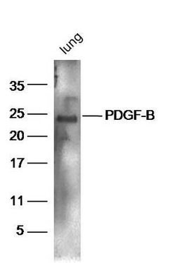 PDGF B Rabbit anti-Human, Polyclonal, Bioss 100 &mu;L; Unconjugated:Antibodies,