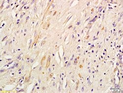 IRS-3 Rabbit anti-Mouse Rat, Polyclonal, Bioss 100 &mu;L; Unconjugated:Antibodies,