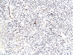 TrkA Rabbit anti-Human, Polyclonal, Bioss 100 &mu;L | Buy Online | Bioss | Fisher Scientific