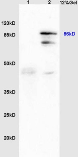 GRP94 Rabbit anti-Human, Polyclonal, Bioss 100 &mu;L; Unconjugated:Antibodies,