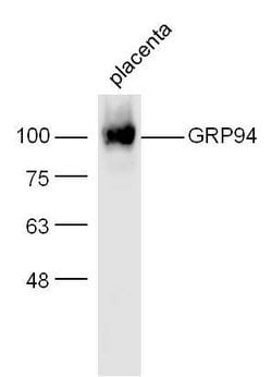 GRP94 Rabbit anti-Human, Polyclonal, Bioss 100 &mu;L; Unconjugated:Antibodies,