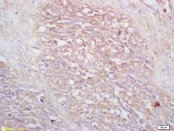 VPAC2R Rabbit anti-Human, Polyclonal, Bioss 100 &mu;L; Unconjugated:Antibodies,