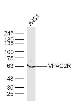 VPAC2R Rabbit anti-Human, Polyclonal, Bioss 100 &mu;L; Unconjugated:Antibodies,