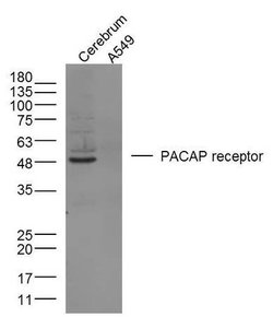 PACAP receptor 1 Rabbit anti-Human, Polyclonal, Bioss 100 &mu;L; Unconjugated:Antibodies,