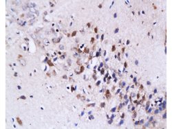 Fas Ligand Rabbit anti-Human, Polyclonal, Bioss 100 &mu;L; Unconjugated:Antibodies,