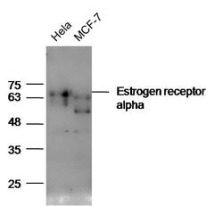Estrogen receptor alpha Rabbit anti-Human, Polyclonal, Bioss 100 &mu;L;