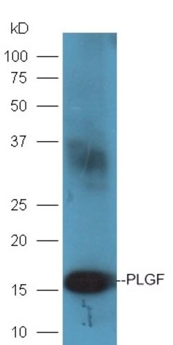 PLGF Rabbit anti-Human, Polyclonal, Bioss 100 &mu;L; Unconjugated:Antibodies,