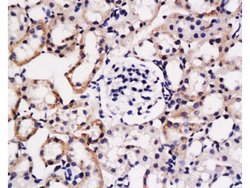 FGL2 Rabbit anti-Human, Polyclonal, Bioss 100 &mu;L; Unconjugated:Antibodies,