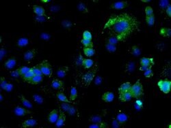 ILK-1 Rabbit anti-Human, Polyclonal, Bioss 100 &mu;L; Unconjugated:Antibodies,