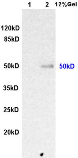 ILK-1 Rabbit anti-Human, Polyclonal, Bioss 100 &mu;L; Unconjugated:Antibodies,