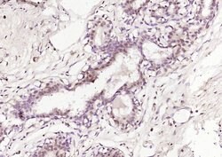 PADI4 Rabbit anti-Human, Polyclonal, Bioss 100 &mu;L; Unconjugated:Antibodies,