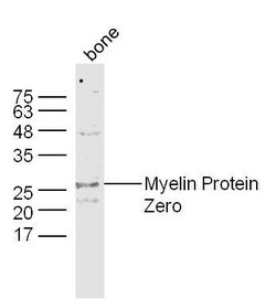 Myelin Protein Zero Rabbit anti-Human, Polyclonal, Bioss 100 &mu;L; Unconjugated:Antibodies,