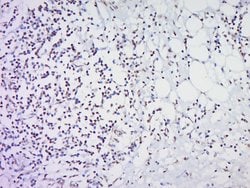 HOXc8 Rabbit anti-Human, Polyclonal, Bioss 100 &mu;L; Unconjugated:Antibodies,