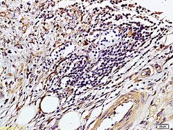 TIMP-1 Rabbit anti-Human, Polyclonal, Bioss 100 &mu;L; Unconjugated:Antibodies,