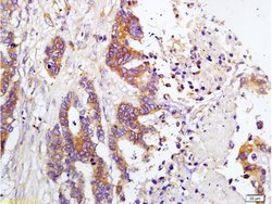 TIMP-1 Rabbit anti-Human, Polyclonal, Bioss 100 &mu;L; Unconjugated:Antibodies,