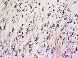 TIMP-1 Rabbit anti-Human, Polyclonal, Bioss 100 &mu;L; Unconjugated:Antibodies,