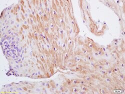TIMP-1 Rabbit anti-Human, Polyclonal, Bioss 100 &mu;L; Unconjugated:Antibodies,