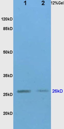 TIMP-1 Rabbit anti-Human, Polyclonal, Bioss 100 &mu;L; Unconjugated:Antibodies,