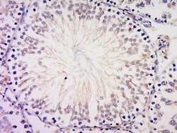 PIBF Rabbit anti-Human, Polyclonal, Bioss 100 &mu;L; Unconjugated:Antibodies,