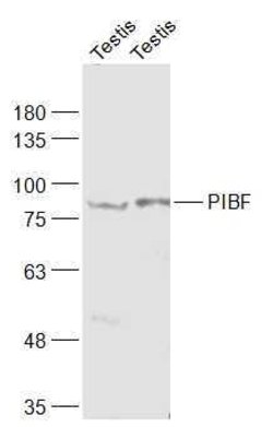 PIBF Rabbit anti-Human, Polyclonal, Bioss 100 &mu;L; Unconjugated:Antibodies,