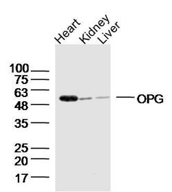 OPG Rabbit anti-Human, Polyclonal, Bioss 100 &mu;L; Unconjugated:Antibodies,