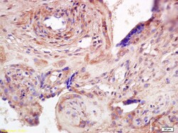 ADAMTS7 Rabbit anti-Human, Polyclonal, Bioss 100 &mu;L; Unconjugated:Antibodies,