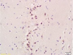 NIS Rabbit anti-Human, Polyclonal, Bioss 100 &mu;L; Unconjugated:Antibodies,