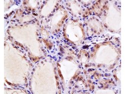 NIS Rabbit anti-Human, Polyclonal, Bioss 100 &mu;L; Unconjugated:Antibodies,