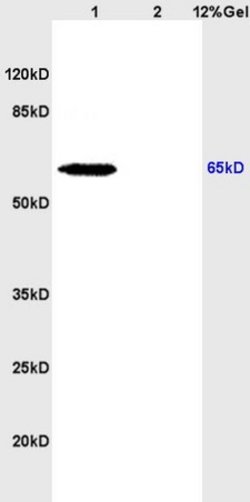 NIS Rabbit anti-Human, Polyclonal, Bioss 100 &mu;L; Unconjugated:Antibodies,