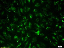 CD31 Rabbit anti-Human, Polyclonal, Bioss 100 &mu;L; Unconjugated:Antibodies,