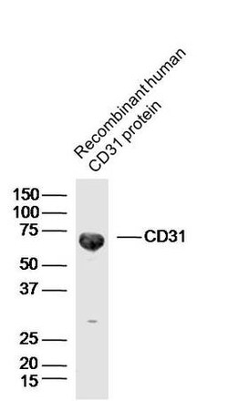 CD31 Rabbit anti-Human, Polyclonal, Bioss 100 &mu;L; Unconjugated:Antibodies,