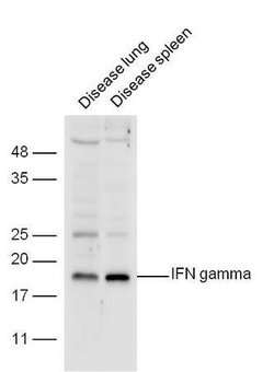 IFN gamma Rabbit anti-Human, Polyclonal, Bioss 100 &mu;L; Unconjugated:Antibodies,