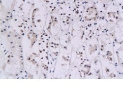 IFN gamma Rabbit anti-Human, Polyclonal, Bioss 100 &mu;L; Unconjugated:Antibodies,