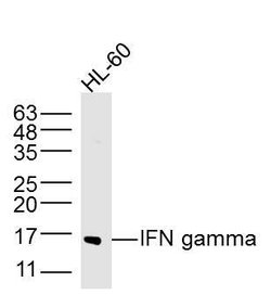 IFN gamma Rabbit anti-Human, Polyclonal, Bioss 100 &mu;L; Unconjugated:Antibodies,