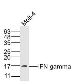 IFN gamma Rabbit anti-Human, Polyclonal, Bioss 100 &mu;L; Unconjugated:Antibodies,