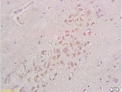 Integrin beta 1 Rabbit anti-Human, Polyclonal, Bioss 100 &mu;L; Unconjugated:Antibodies,