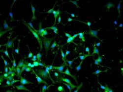Dnmt3a Rabbit anti-Human, Polyclonal, Bioss 100 &mu;L; Unconjugated:Antibodies,