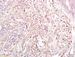 Dnmt3a Rabbit anti-Human, Polyclonal, Bioss 100 &mu;L; Unconjugated:Antibodies,