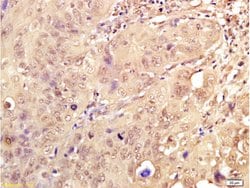 Dnmt3a Rabbit anti-Human, Polyclonal, Bioss 100 &mu;L; Unconjugated:Antibodies,
