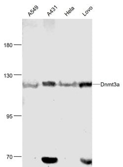Dnmt3a Rabbit anti-Human, Polyclonal, Bioss 100 &mu;L; Unconjugated:Antibodies,