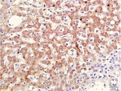 RAR Beta Rabbit anti-Human, Polyclonal, Bioss 100 &mu;L; Unconjugated:Antibodies,