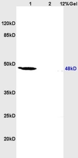 RAR Beta Rabbit anti-Human, Polyclonal, Bioss 100 &mu;L; Unconjugated:Antibodies,