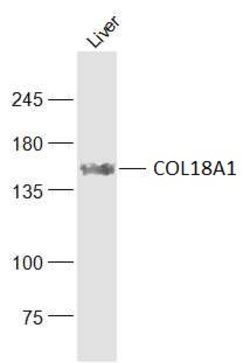 COL18A1 Rabbit anti-Human, Polyclonal, Bioss 100 &mu;L; Unconjugated:Antibodies,