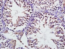 Mfn1 Rabbit anti-Human, Polyclonal, Bioss 100 &mu;L; Unconjugated:Antibodies,