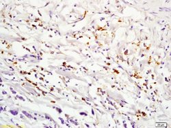 IL2RA Rabbit anti-Human, Polyclonal, Bioss 100 &mu;L; Unconjugated:Antibodies,